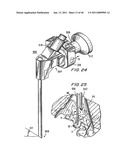 METHODS AND APPARATUSES FOR STABILIZING THE SPINE THROUGH AN ACCESS DEVICE diagram and image