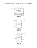 ORTHOPEDIC SUPPORT LOCATING OR CENTERING FEATURE AND METHOD diagram and image