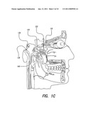 SKULL-MOUNTED ELECTRICAL STIMULATION SYSTEM AND METHOD FOR TREATING PATIENTS diagram and image