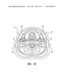 SKULL-MOUNTED ELECTRICAL STIMULATION SYSTEM AND METHOD FOR TREATING PATIENTS diagram and image