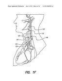 SKULL-MOUNTED ELECTRICAL STIMULATION SYSTEM AND METHOD FOR TREATING PATIENTS diagram and image