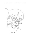 SKULL-MOUNTED ELECTRICAL STIMULATION SYSTEM AND METHOD FOR TREATING PATIENTS diagram and image