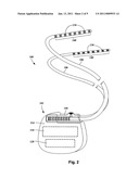 PIGGY-BACK PERCUTANEOUS LEAD INSERTION KIT diagram and image