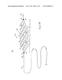 VASCULAR AND BODILY DUCT TREATMENT DEVICES AND METHODS diagram and image