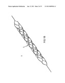 VASCULAR AND BODILY DUCT TREATMENT DEVICES AND METHODS diagram and image