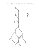 VASCULAR AND BODILY DUCT TREATMENT DEVICES AND METHODS diagram and image