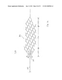 VASCULAR AND BODILY DUCT TREATMENT DEVICES AND METHODS diagram and image