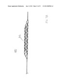 VASCULAR AND BODILY DUCT TREATMENT DEVICES AND METHODS diagram and image