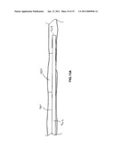 VASCULAR AND BODILY DUCT TREATMENT DEVICES AND METHODS diagram and image