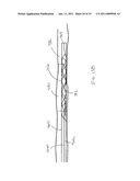 VASCULAR AND BODILY DUCT TREATMENT DEVICES AND METHODS diagram and image