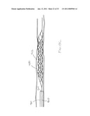 VASCULAR AND BODILY DUCT TREATMENT DEVICES AND METHODS diagram and image