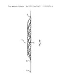 VASCULAR AND BODILY DUCT TREATMENT DEVICES AND METHODS diagram and image