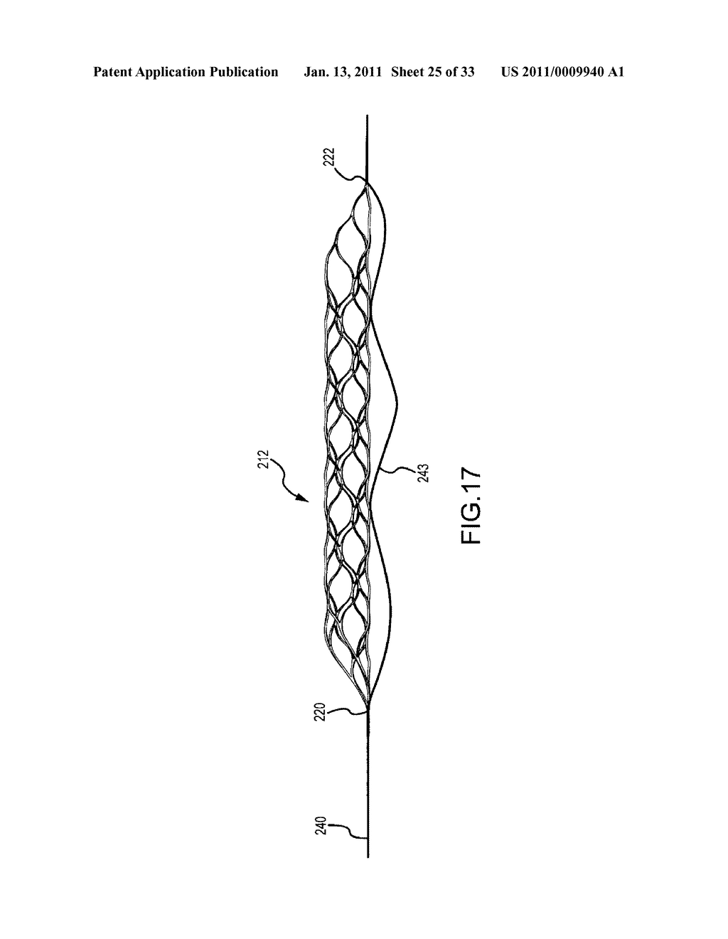 VASCULAR AND BODILY DUCT TREATMENT DEVICES AND METHODS - diagram, schematic, and image 26