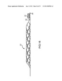 VASCULAR AND BODILY DUCT TREATMENT DEVICES AND METHODS diagram and image