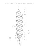 VASCULAR AND BODILY DUCT TREATMENT DEVICES AND METHODS diagram and image