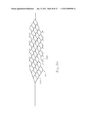 VASCULAR AND BODILY DUCT TREATMENT DEVICES AND METHODS diagram and image