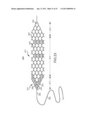 VASCULAR AND BODILY DUCT TREATMENT DEVICES AND METHODS diagram and image