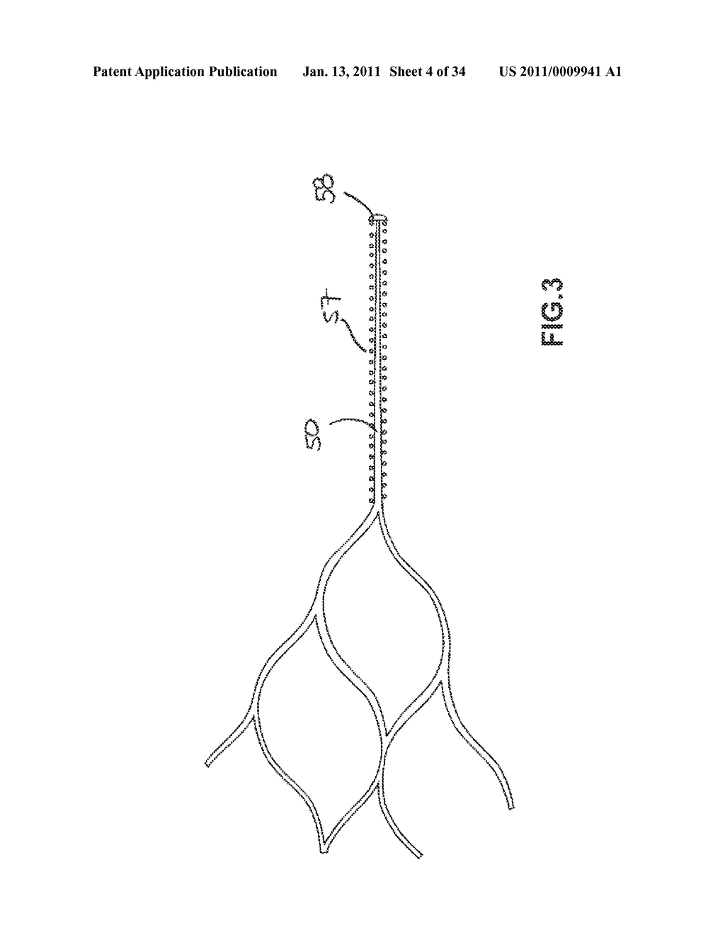 VASCULAR AND BODILY DUCT TREATMENT DEVICES AND METHODS - diagram, schematic, and image 05