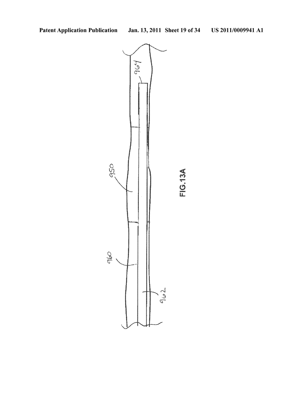 VASCULAR AND BODILY DUCT TREATMENT DEVICES AND METHODS - diagram, schematic, and image 20