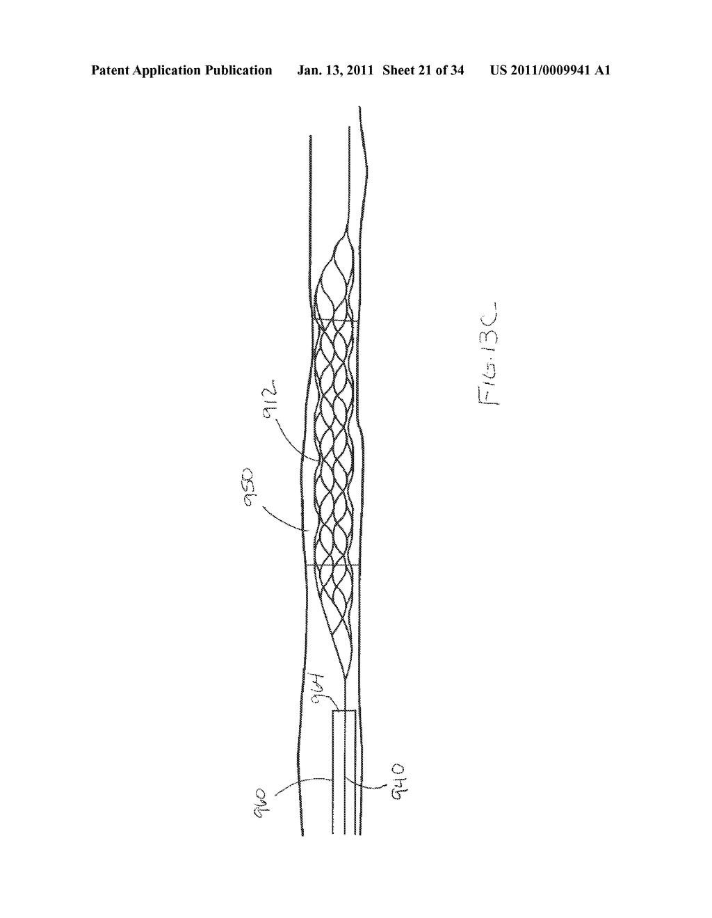 VASCULAR AND BODILY DUCT TREATMENT DEVICES AND METHODS - diagram, schematic, and image 22