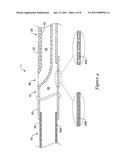 BALLOON CATHETER diagram and image