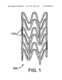 Nanoparticle loaded electrospun implants or coatings for drug release diagram and image