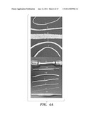 PROSTHETIC FABRIC STRUCTURE diagram and image