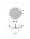 PROSTHETIC FABRIC STRUCTURE diagram and image