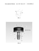 PARTIAL JOINT RESURFACING IMPLANT, INSTRUMENTATION AND METHOD diagram and image