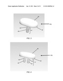 PARTIAL JOINT RESURFACING IMPLANT, INSTRUMENTATION AND METHOD diagram and image