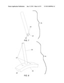 PARTIAL JOINT RESURFACING IMPLANT, INSTRUMENTATION AND METHOD diagram and image