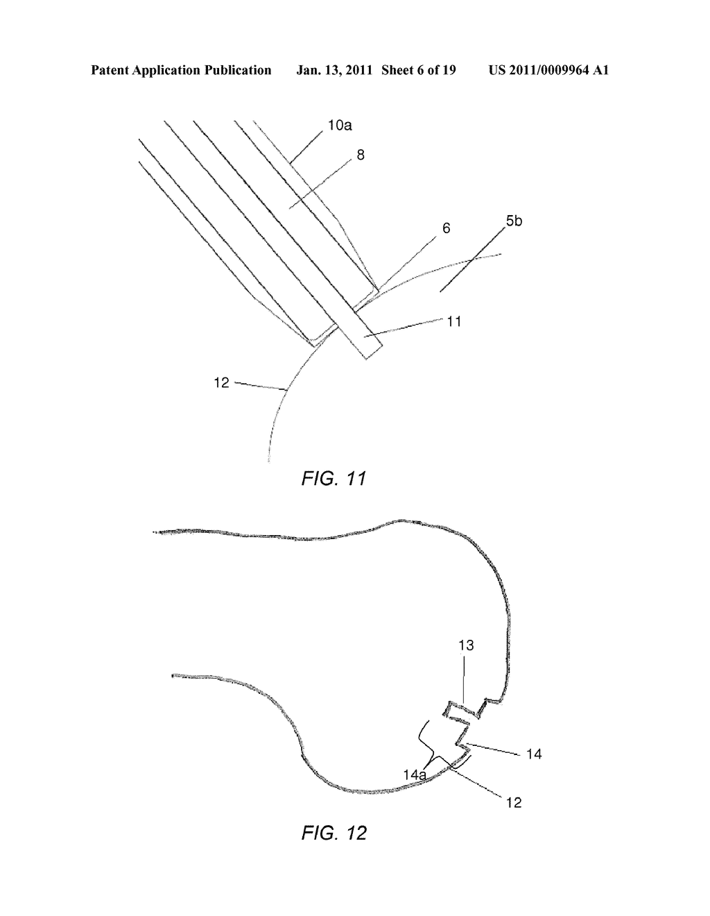PARTIAL JOINT RESURFACING IMPLANT, INSTRUMENTATION AND METHOD - diagram, schematic, and image 07