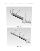 PARTIAL JOINT RESURFACING IMPLANT, INSTRUMENTATION AND METHOD diagram and image