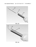 PARTIAL JOINT RESURFACING IMPLANT, INSTRUMENTATION AND METHOD diagram and image