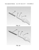 PARTIAL JOINT RESURFACING IMPLANT, INSTRUMENTATION AND METHOD diagram and image