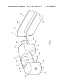 Inter-Body Implantation System and Method diagram and image