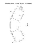 Inter-Body Implantation System and Method diagram and image