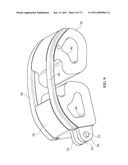 Inter-Body Implantation System and Method diagram and image