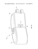 Inter-Body Implantation System and Method diagram and image