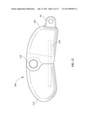 Inter-Body Implantation System and Method diagram and image