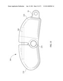 Inter-Body Implantation System and Method diagram and image