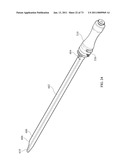 Inter-Body Implantation System and Method diagram and image