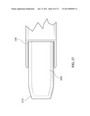 Inter-Body Implantation System and Method diagram and image