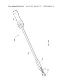 Inter-Body Implantation System and Method diagram and image