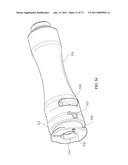 Inter-Body Implantation System and Method diagram and image