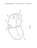 Inter-Body Implantation System and Method diagram and image