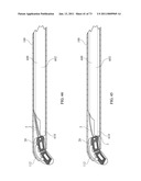 Inter-Body Implantation System and Method diagram and image