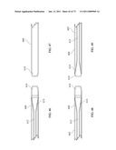 Inter-Body Implantation System and Method diagram and image