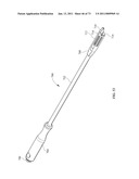 Inter-Body Implantation System and Method diagram and image