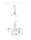 Inter-Body Implantation System and Method diagram and image